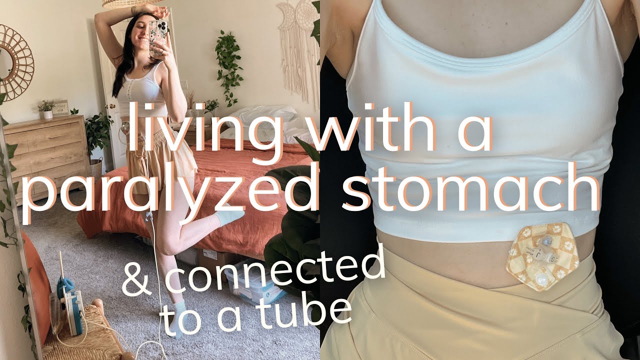day in my life w/ a paralyzed stomach & connected to a feeding tube | gastroparesis awareness month