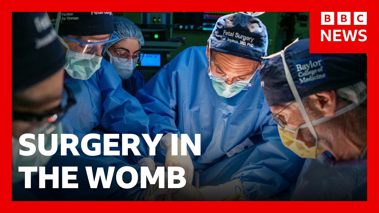 Pioneering womb surgery for 'miracle' baby with intestines outside its body | BBC News
