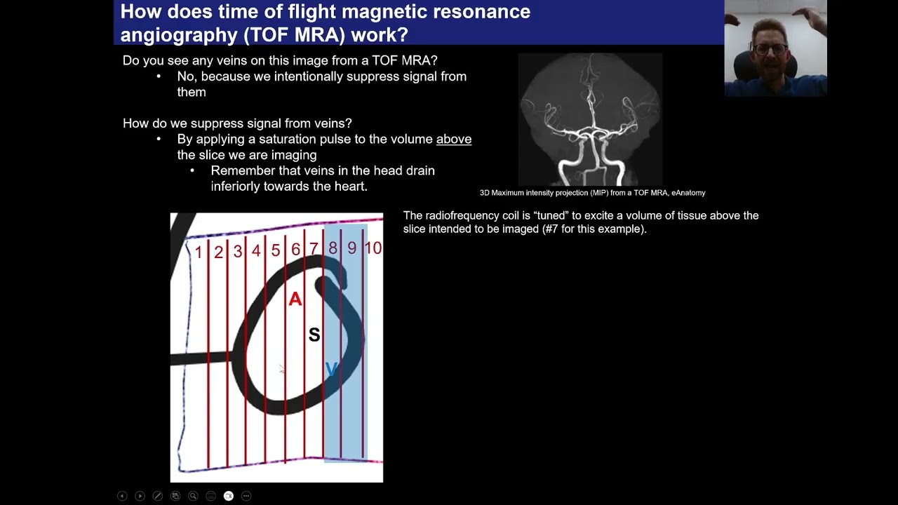 MRI Physics Part 3.1, Time of Flight (TOF) MRA
