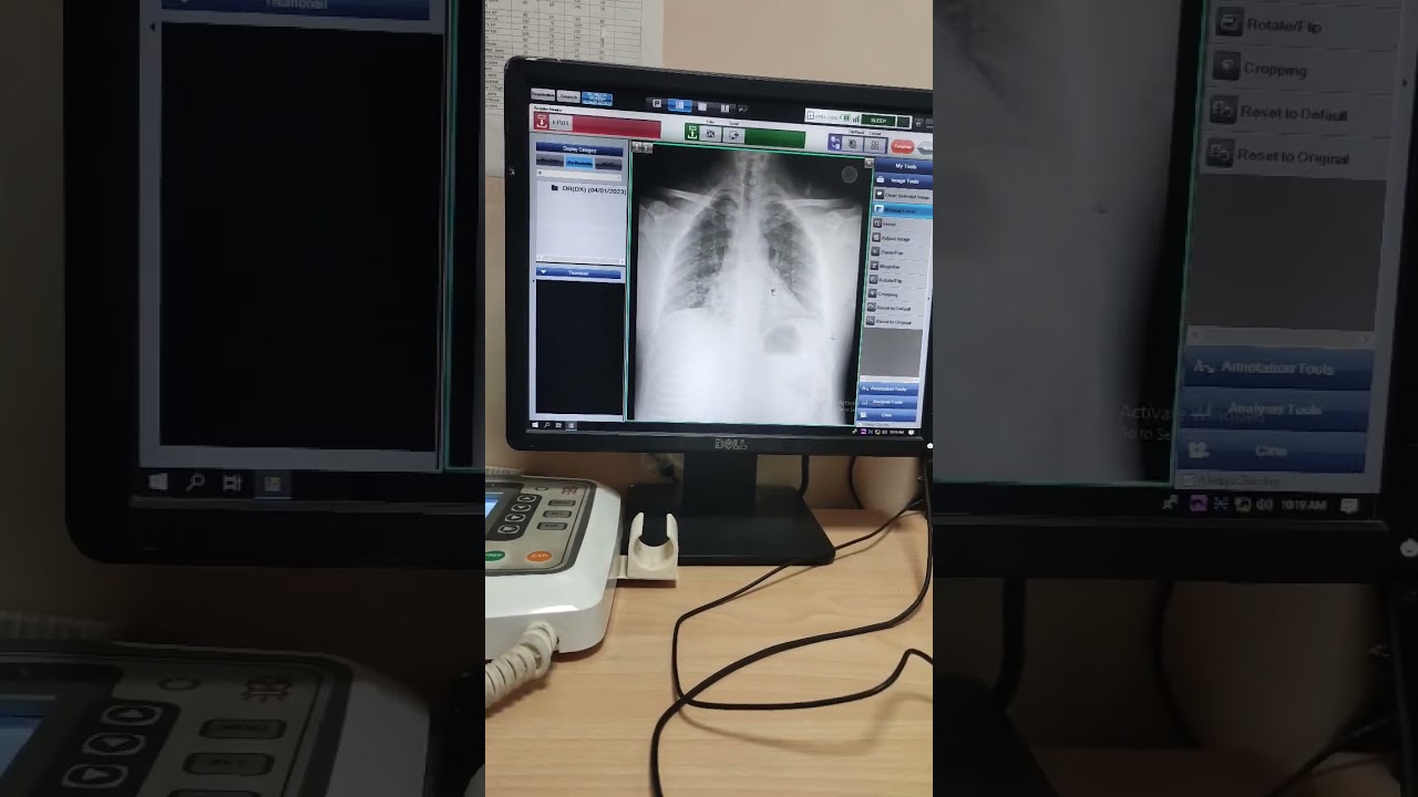 Digital radiography #direct_radiography #DR_system