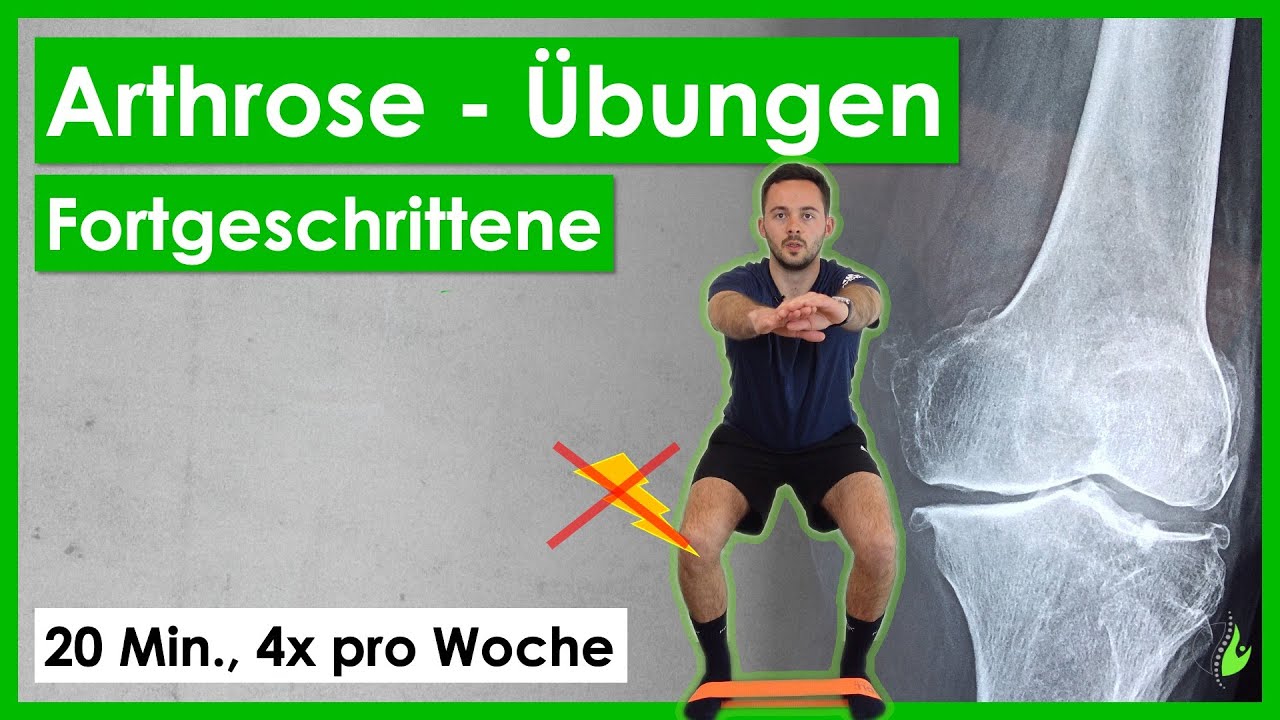 Arthrose⎮Top 4 Übungen für Fortgeschrittene⎮20 Minuten gegen Arthrose