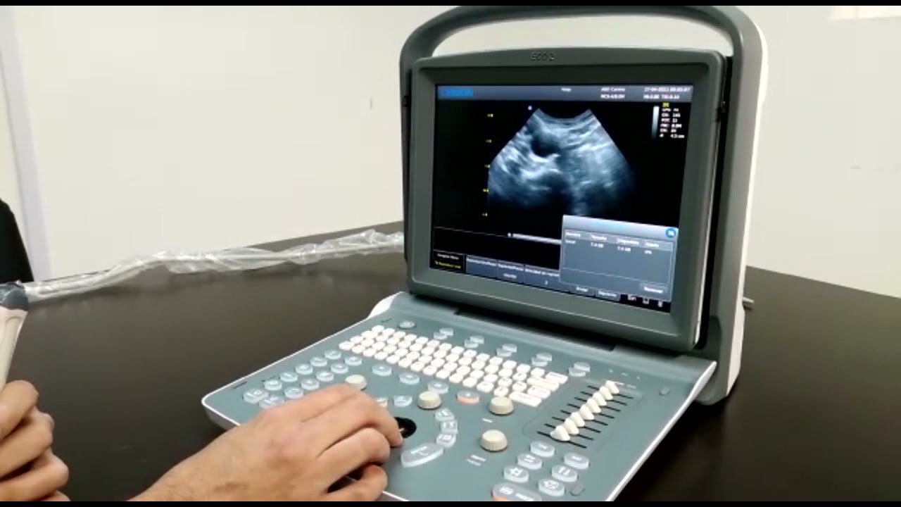 Ecógrafo Veterinario Chison Eco 2