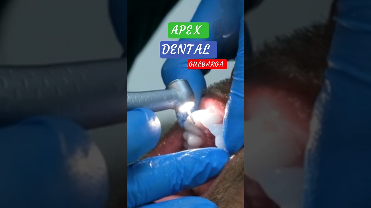 Gulbarga Ka Most Trusted Dental Clinic | Apex Dental Hospital #gulbarga #shorts #dental #kalaburagi