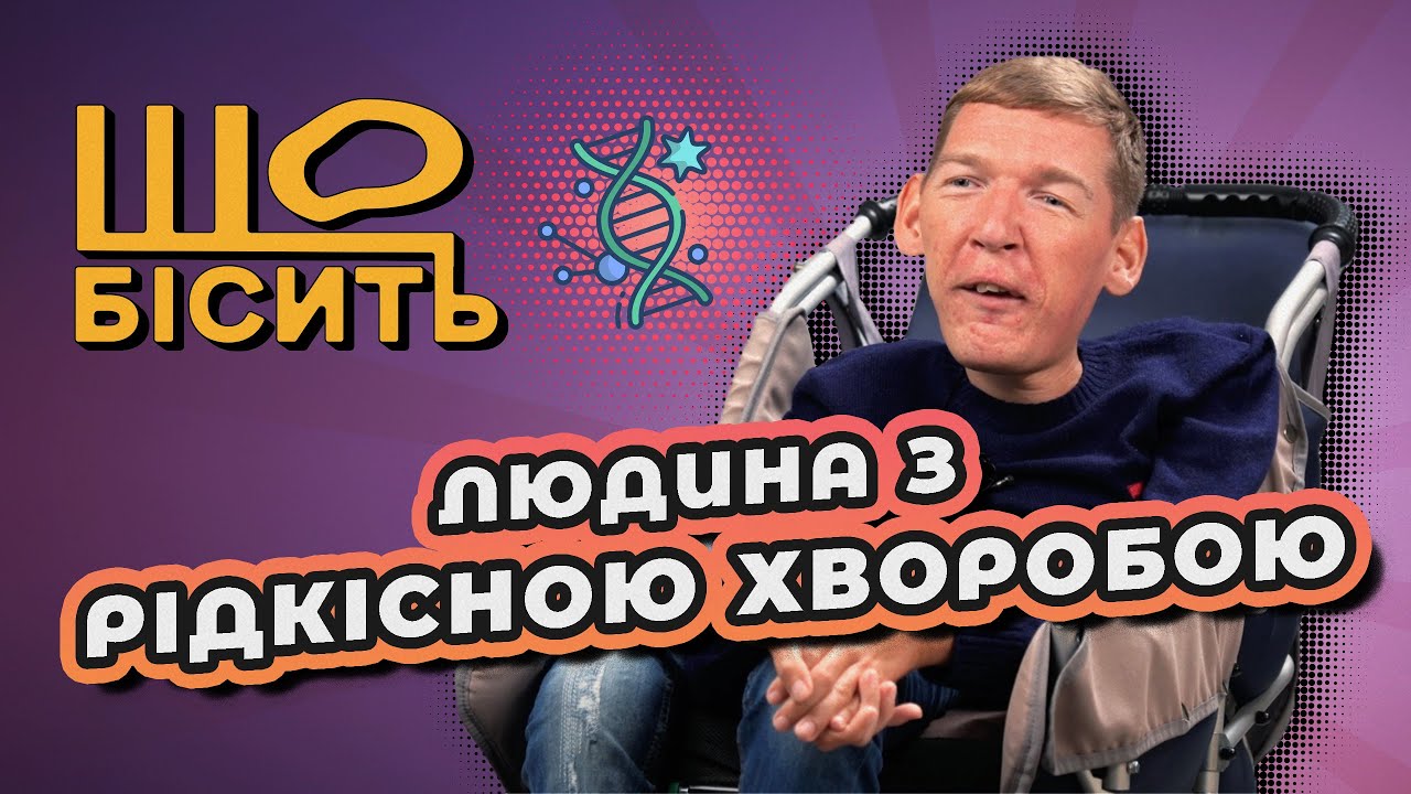 Що Бісить Людину зі СМА | Назарій Гусаков