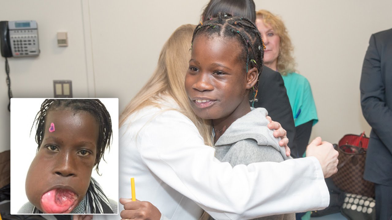 12-Year-Old Girl Smiles Again After 6-Pound Tumor is Removed From Jaw