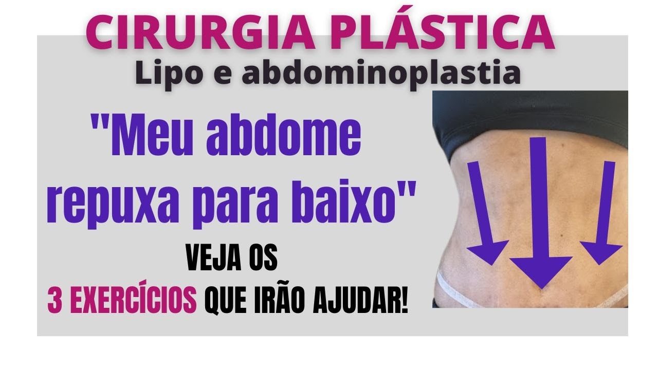 Lipoaspiração e Abdominoplastia: sinto repuxar para baixo ao me levantar...3 exercícios para ajudar!