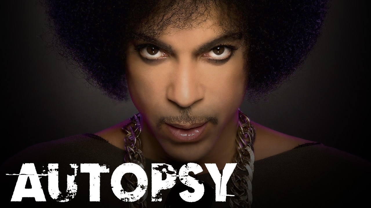 Investigating Prince's Untimely Death: The Shocking Truth | Our History