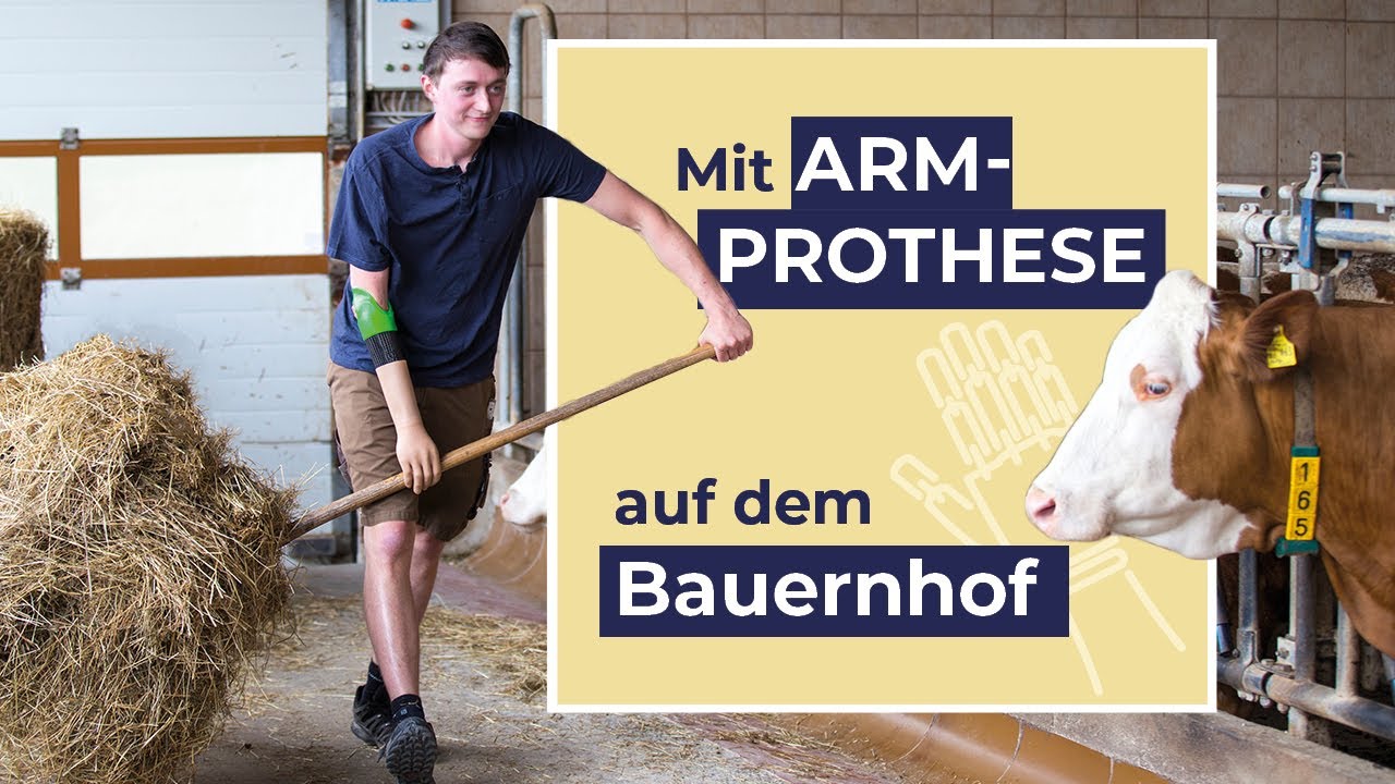Mit myoelektrisch gesteuerter Armprothese auf dem Bauernhof - Pohlig mittendrin