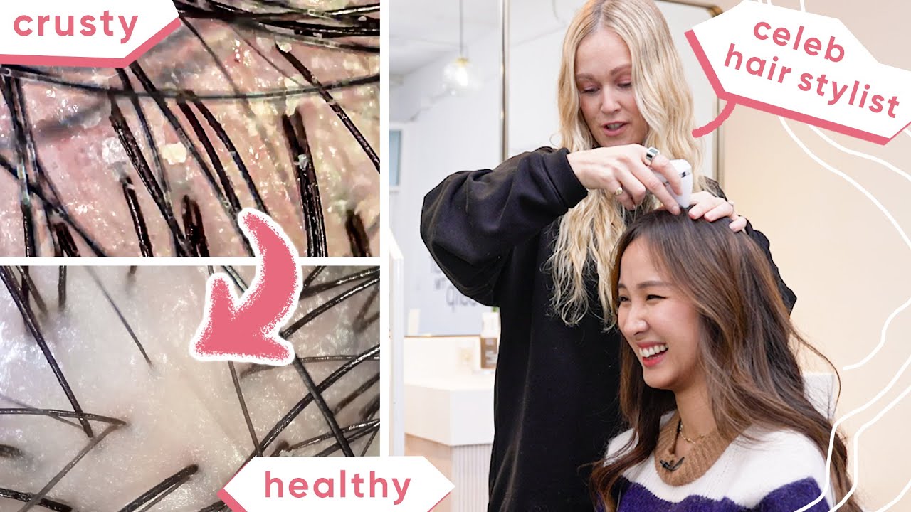 Expert shares WHY you have DANDRUFF & HAIR LOSS 😱 & how to fix it!