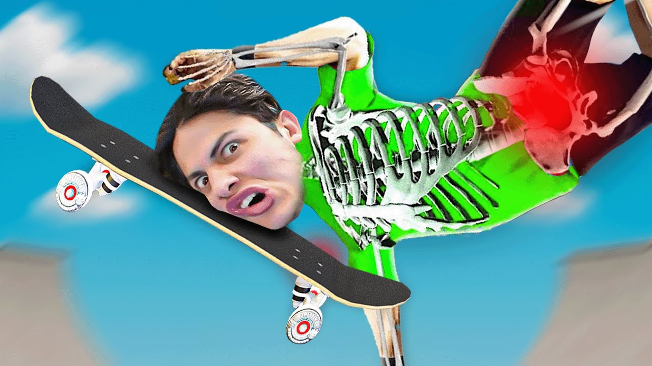 SE PRENDRE UN SKATE EN PLEIN DANS LA TÊTE...