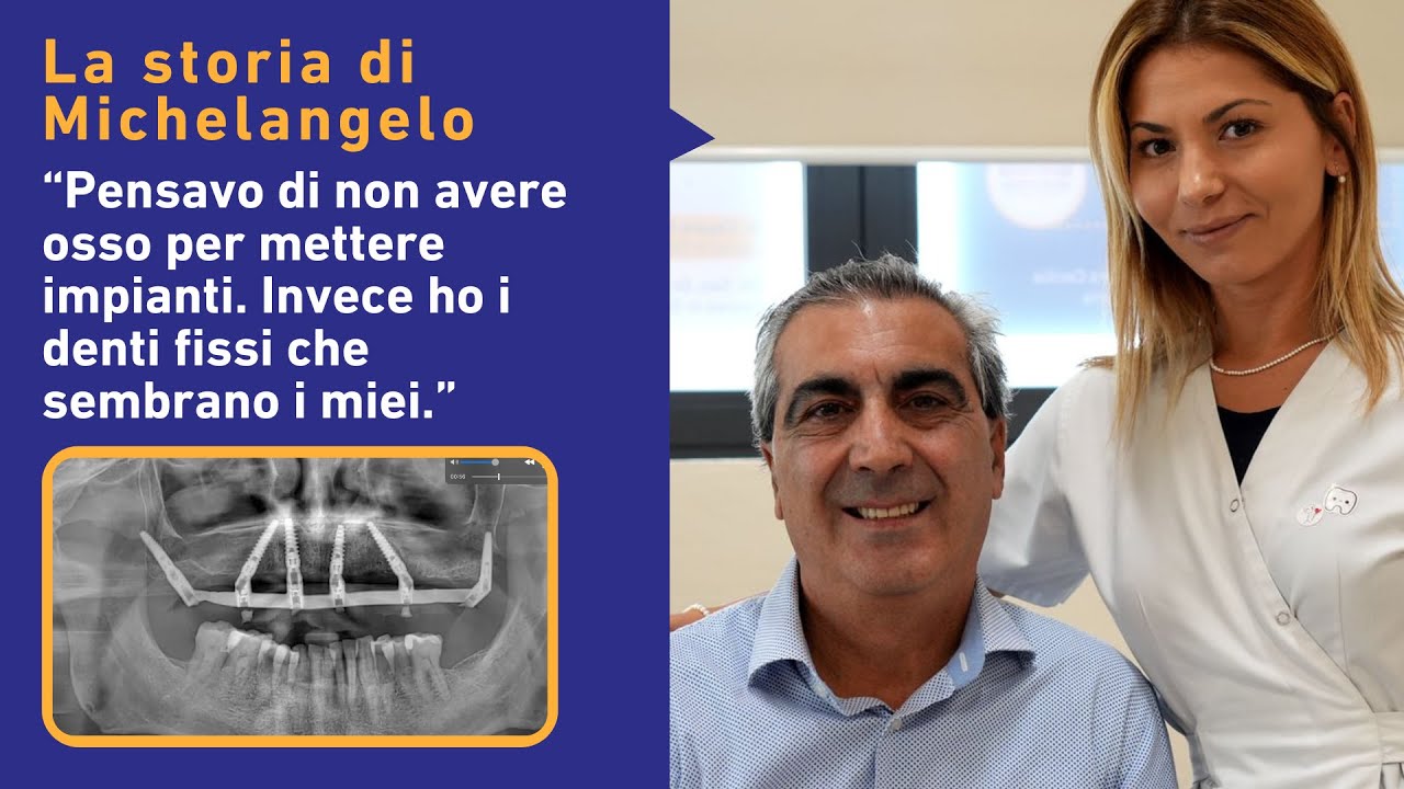 Implantologia a Pistoia: Michelangelo racconta come ha ritrovato il sorriso con i denti fissi.