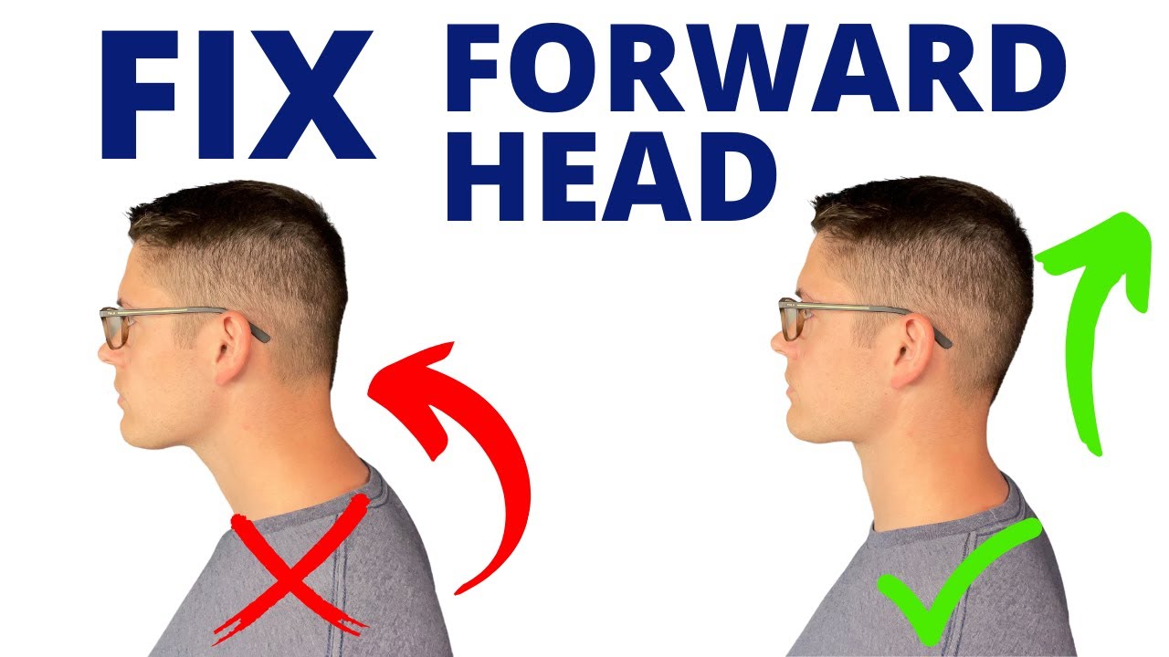 How to Fix Forward Head Posture with 3 Easy Moves