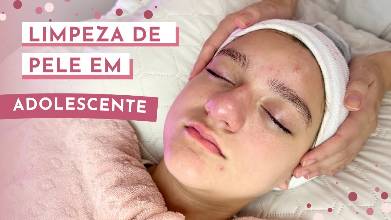 LIMPEZA DE PELE PROFISSIONAL EM ADOLESCENTE