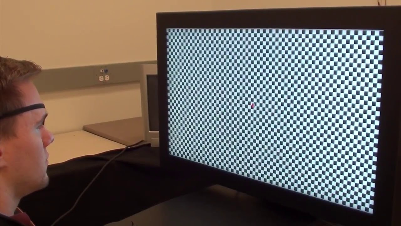 pattern VEP