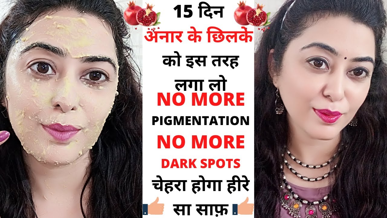 15 Days Challenge  I Removed Dark Spots, pigmentation,open pores,काले दाग झाइयाँ हटा Fair skin पाएँ