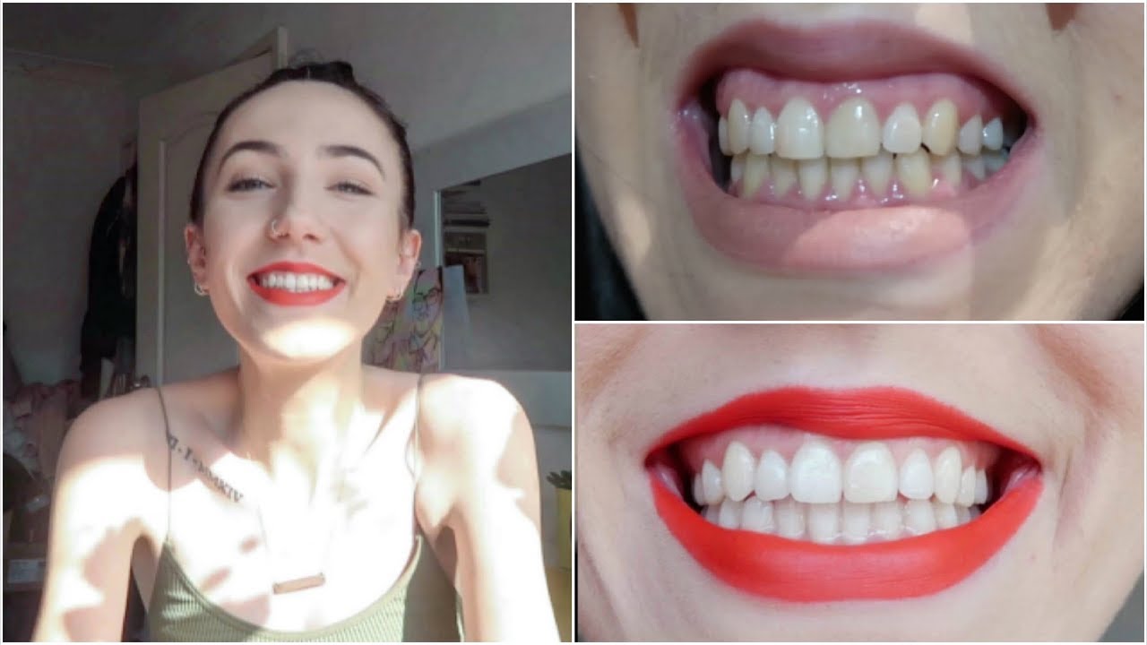 ♡ The Best HOME Teeth Whitening! + Giveaway! | Amy Lee Fisher ♡