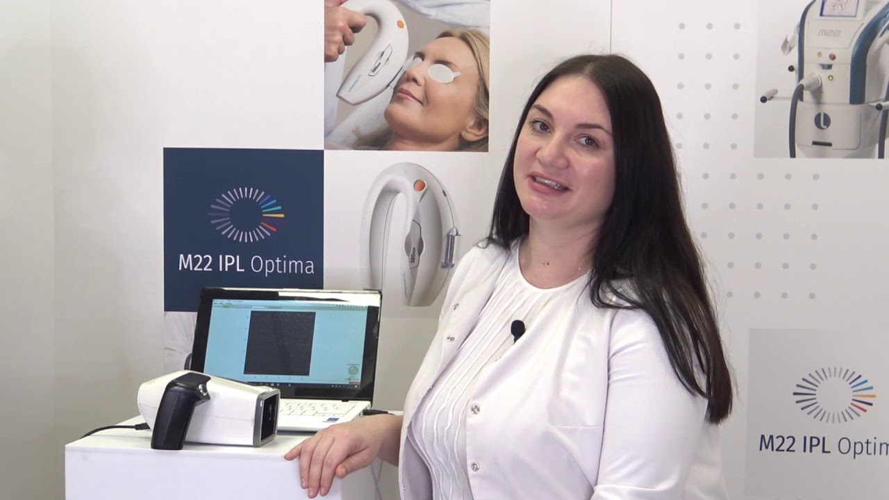 IPL-терапия и синдром сухого глаза. Тандем офтальмологии и косметологии.