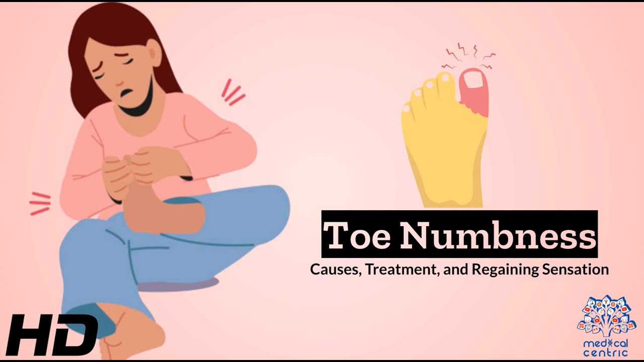 Numb No More: Toe Numbness Demystified with Effective Treatments