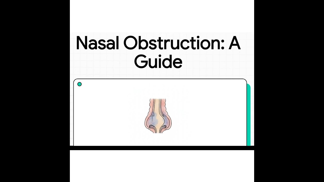 Nasal Obstruction: A Clinical Guide | Evaluation, Causes & Management