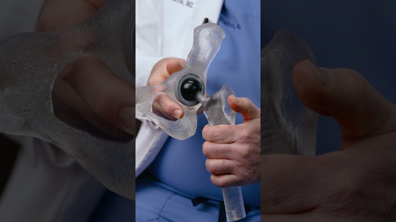 What&rsquo;s Inside a Hip Replacement? #hipreplacement