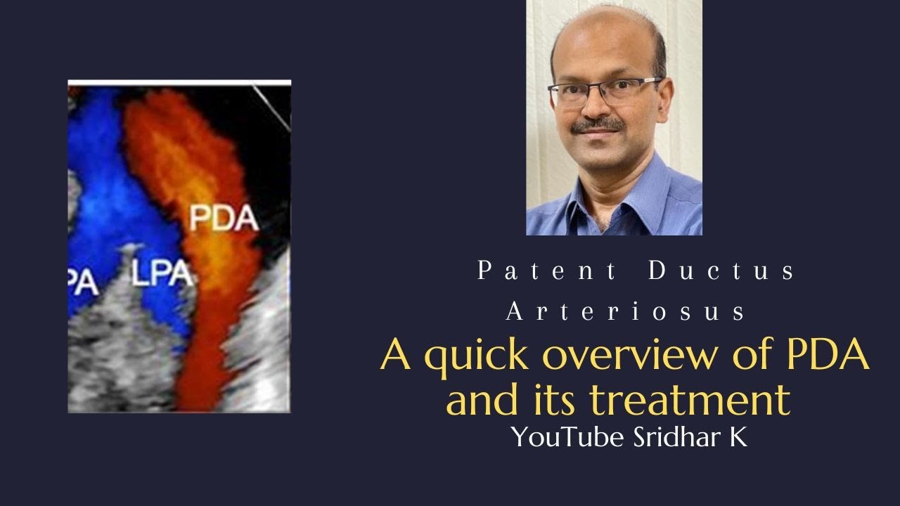 Patent ductus arteriosus and approach to PDA treatment. Dr Sridhar K