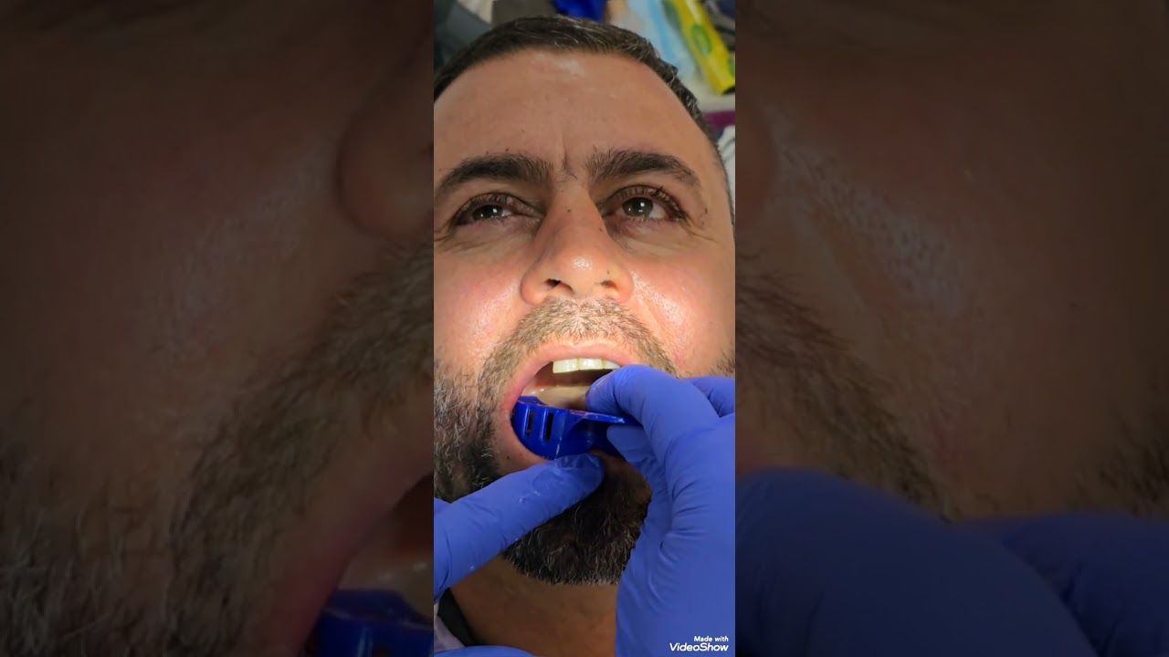 الجلسه الاولئ بروس مرحله رابعه طب أسنان العين 