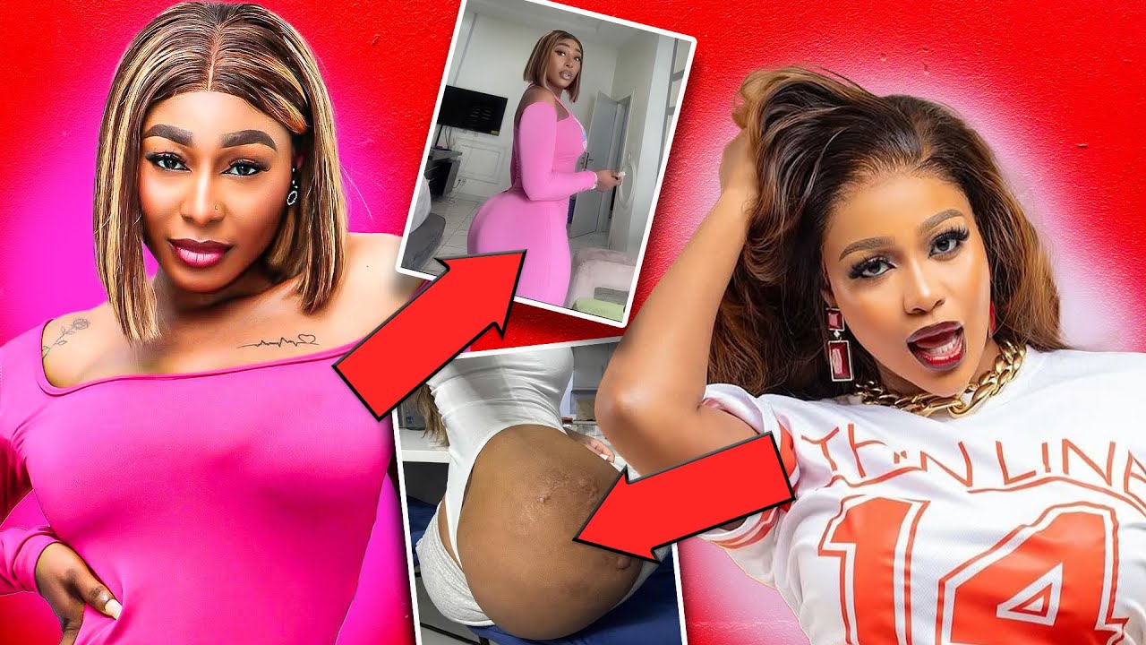 Every Celebrity BBL Sugery Explained in 10 Minute