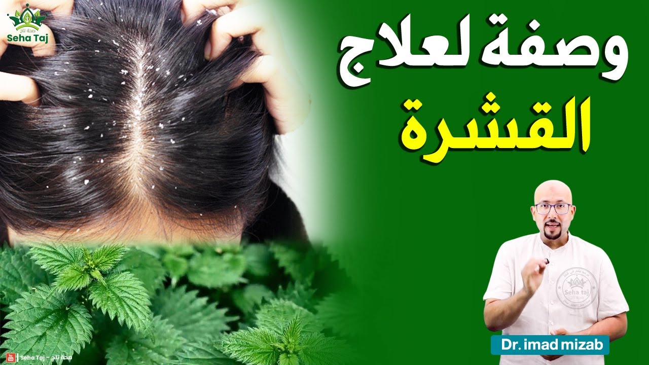 وصفة الحريقة الحرشة للتخلص من القشرة في الشعر  - وصفات الدكتور عماد ميزاب wasafat imad mizab