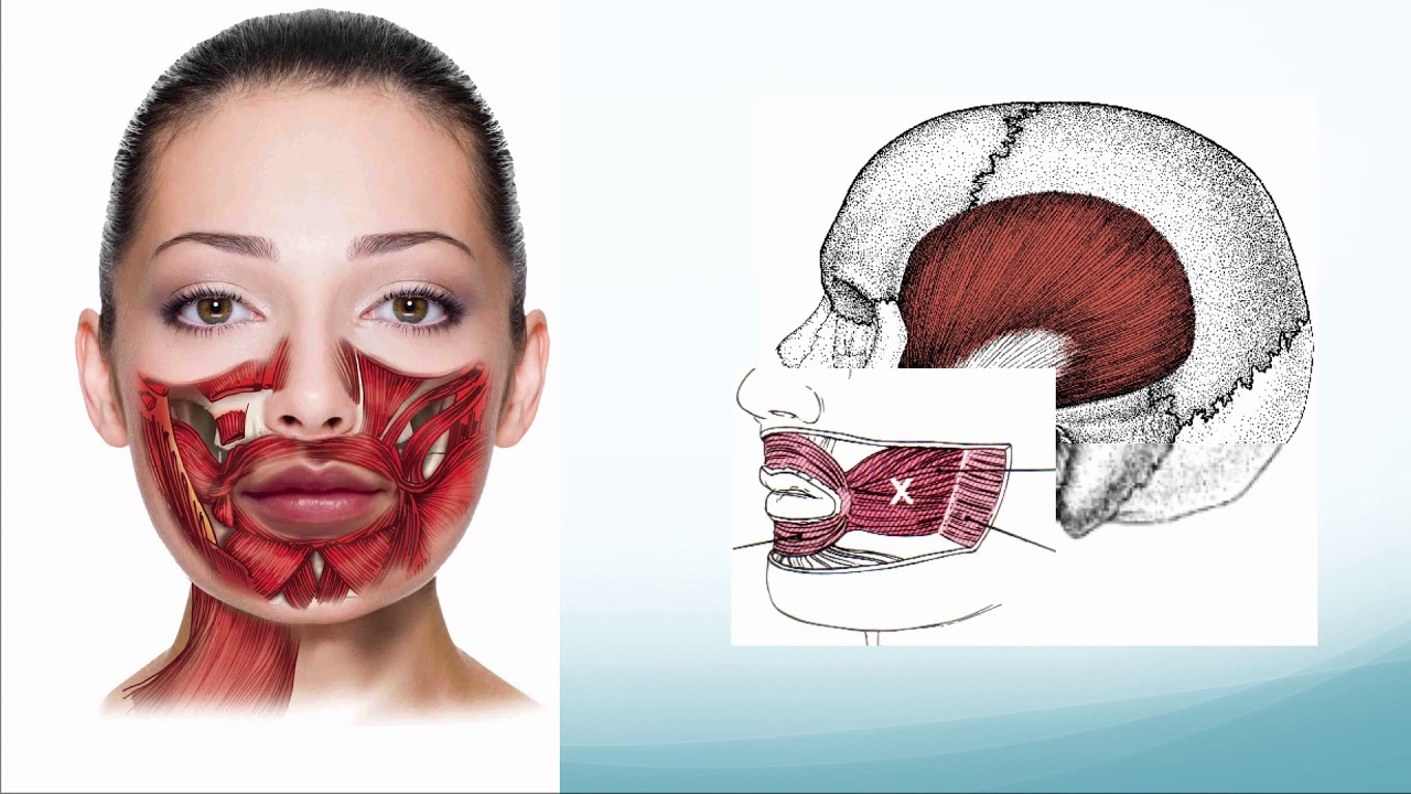 Timothy J. King: Interaction of tongue-tie with the fascia system.