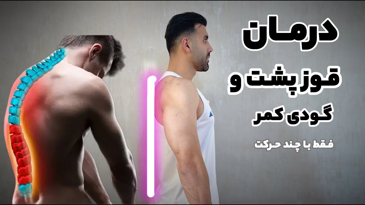 تمرینات رفع گودی کمر و قوز در منزل_آموزش حرکات درمان قوز پشت