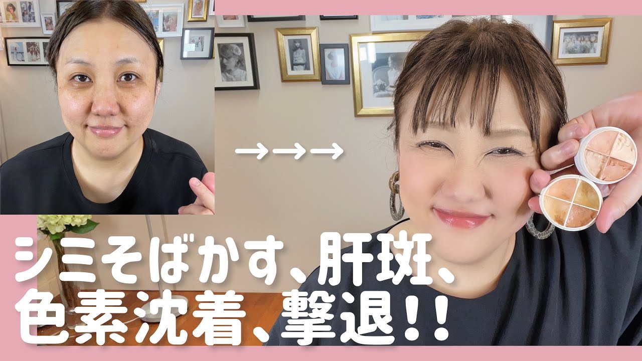 【カバーメイク】お悩みの方集合〜‼️     プロのカバー方法教えまーす😉
