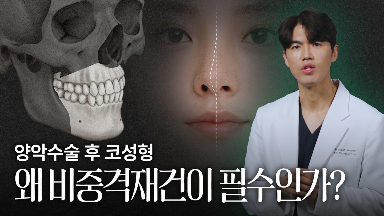 양악수술 후 코성형, 왜 비중격재건이 필수인가? | 늑떼선생김현주