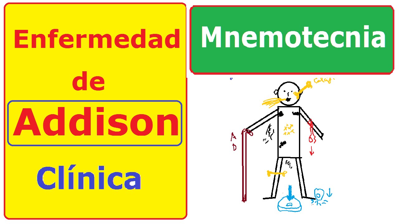 Enfermedad de Addison: memoriza la clínica | Mnemotecnia-clases de medicina
