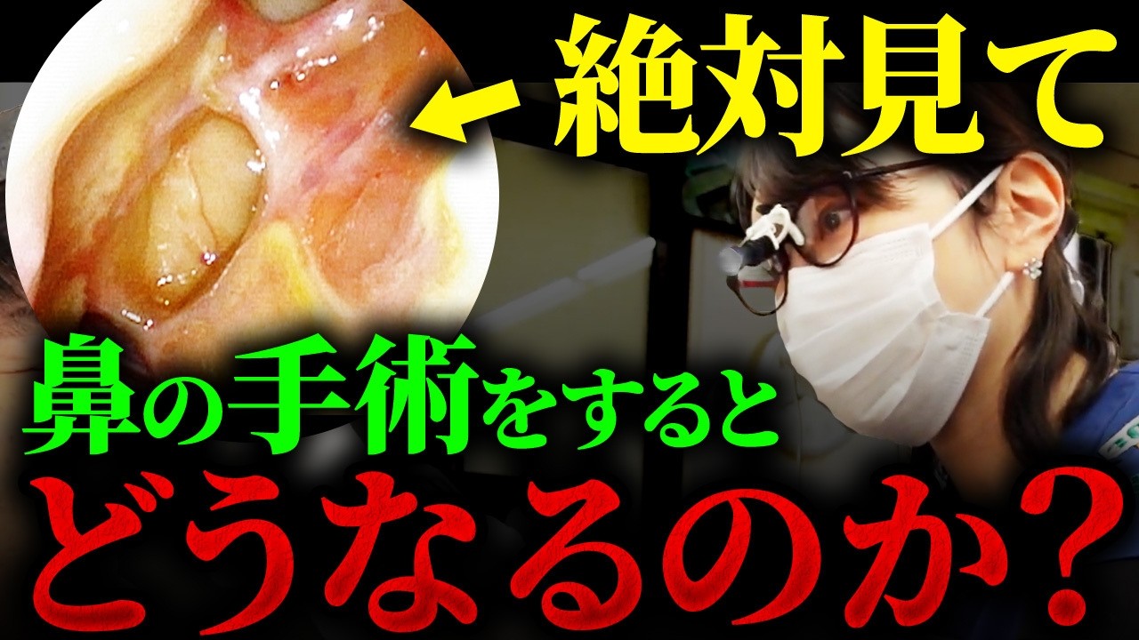 【実はヤバい】鼻を手術したのに呼吸がツラい…それ、エンプティーノーズかも！？
