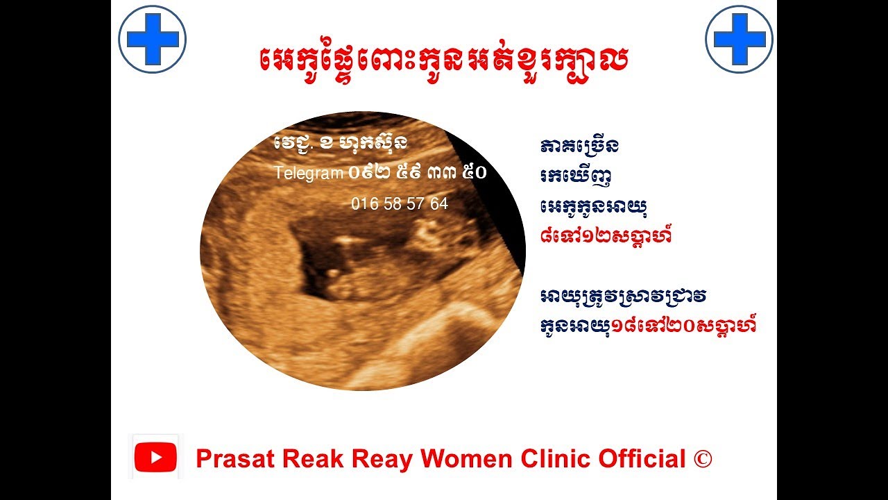 កូនអត់ខួរក្បាល l Anencephaly US l ជំងឺទារកក្នុងផ្ទៃ​ l Prasat Reak Reay Women Clinic Official