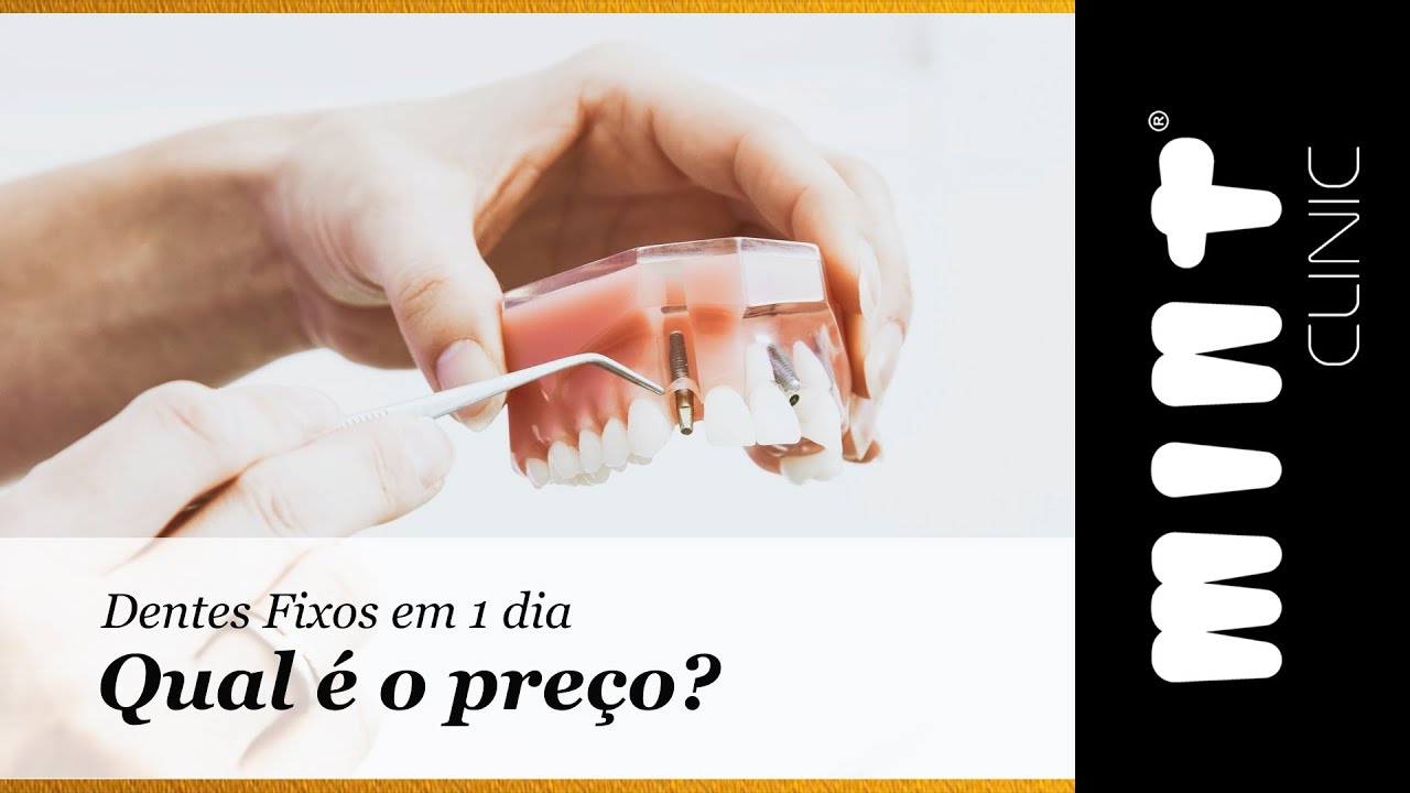 Qual o pre&ccedil;o de colocar dentes fixos em 1 dia? Quanto &eacute; que custa? - Cl&iacute;nica Mint