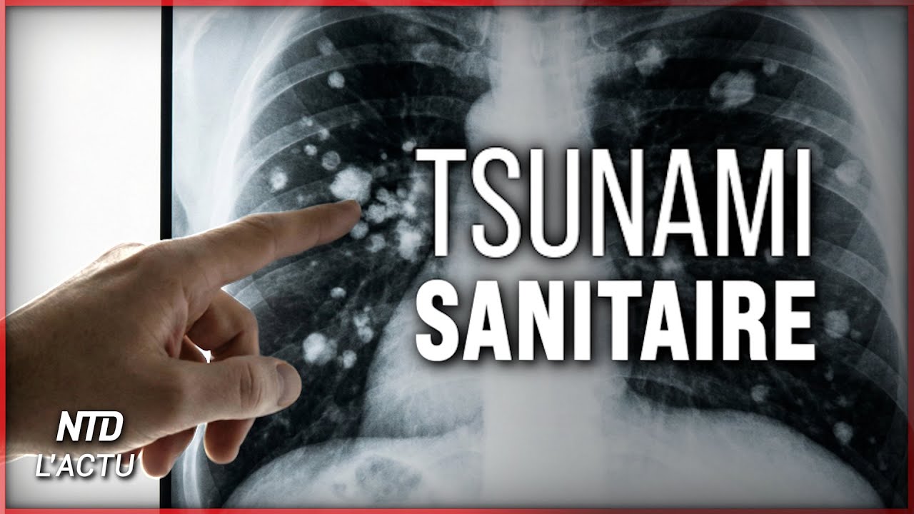 150 millions de Chinois avec des nodules pulmonaires : que se passe-t-il vraiment ?