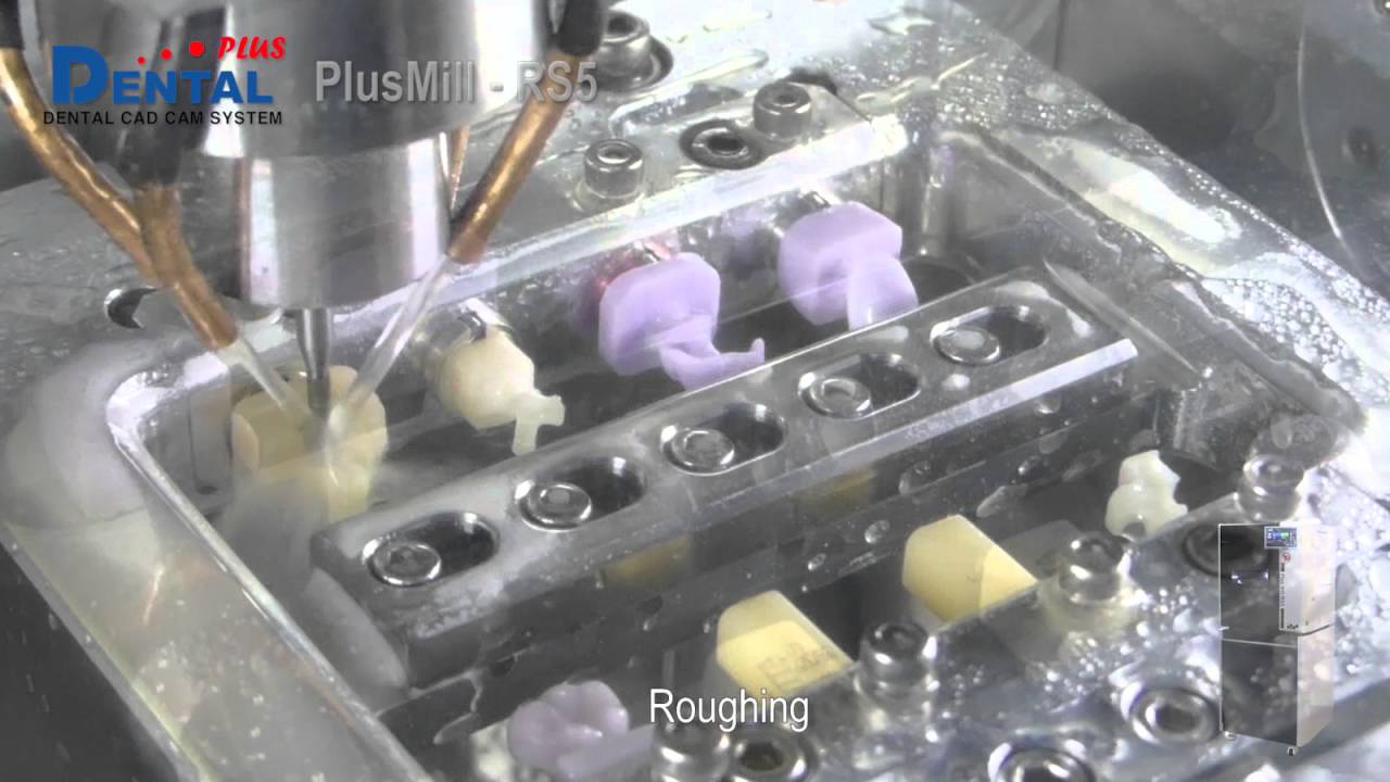 Plus Mill RS5 - Inlay milling