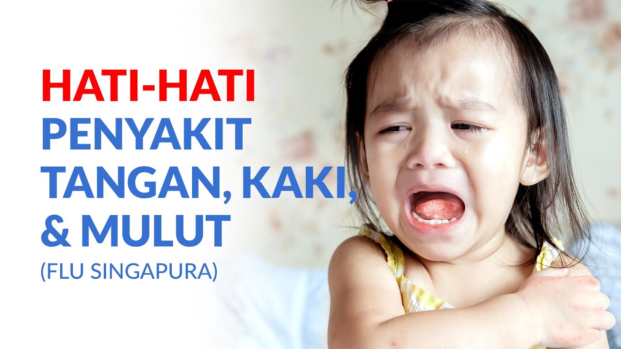 Kenali Flu Singapura atau Penyakit Tangan, Kaki, dan Mulut pada Anak