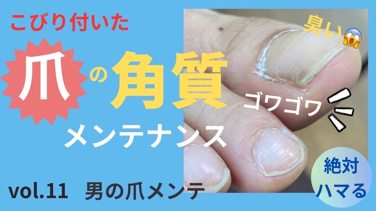 【フットケア】【footcare】ガチガチに硬くなった爪周りの角質！スッキリケア動画。
