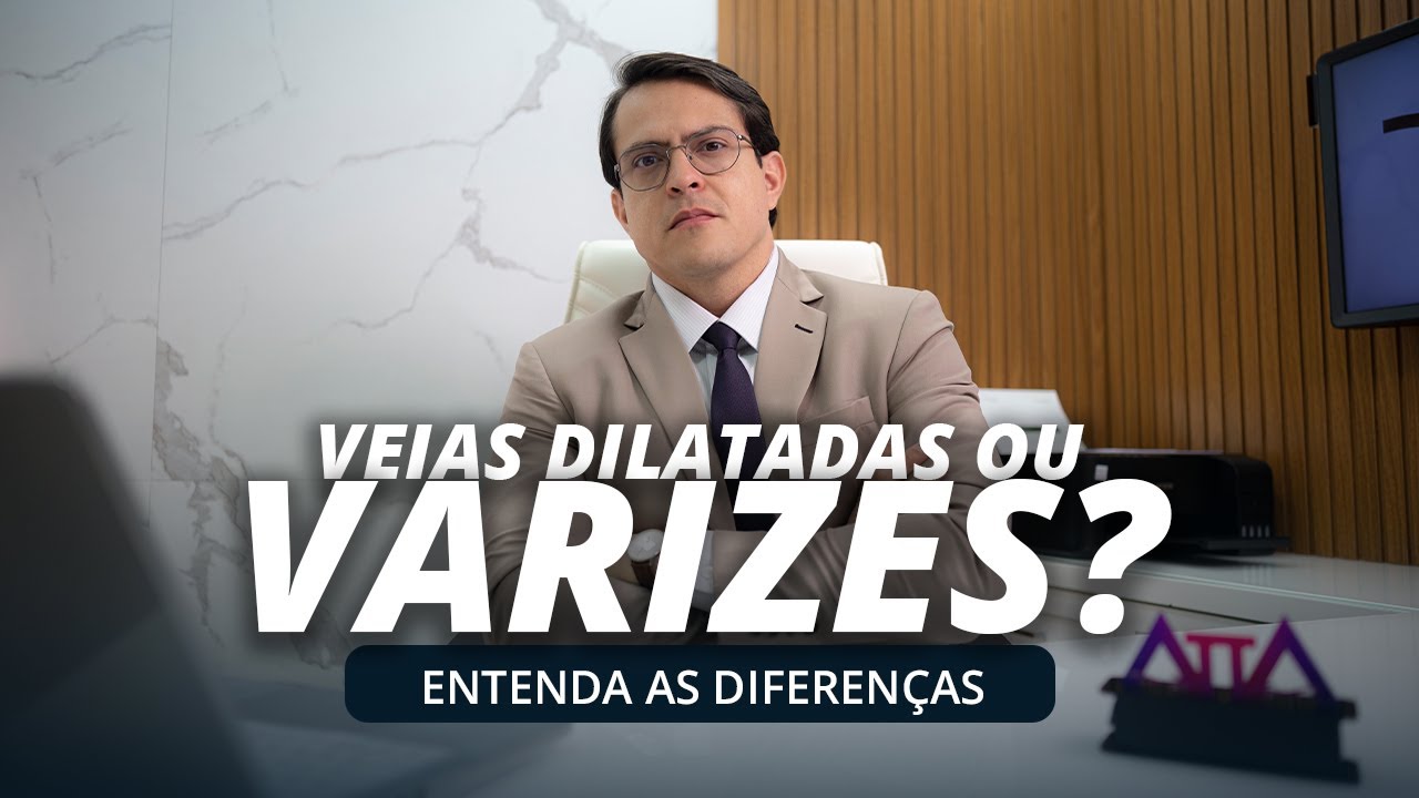 VEIAS DILATADAS ou VARIZES? Saiba as Diferen&ccedil;as e Como Tratar | Dr. Bruno Cangu&ccedil;u