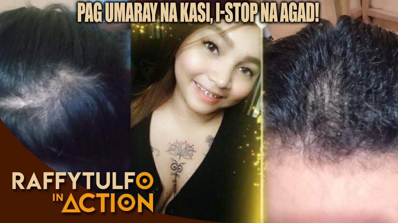 PANOORIN KUNG BAKIT NALALAGAS ANG BUHOK NI ATE!