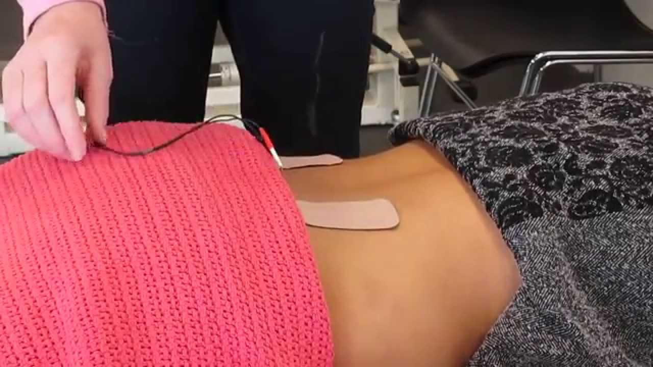 TENS - Application to the low back (as an example)