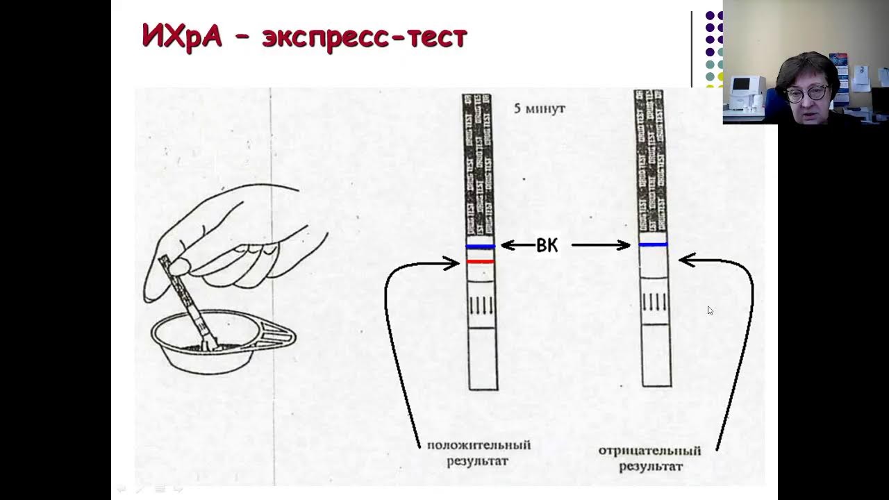 Лекция_5_01.04.22 5кЛФ Лабораторная диагностика инфекционных заболеваний. доц.каф.Стюф И.Ю.