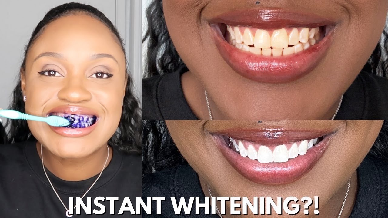 I INSTANTLY WHITENED MY TEETH IN 30 SECONDS USING HISMILE?! *Shocking Results*