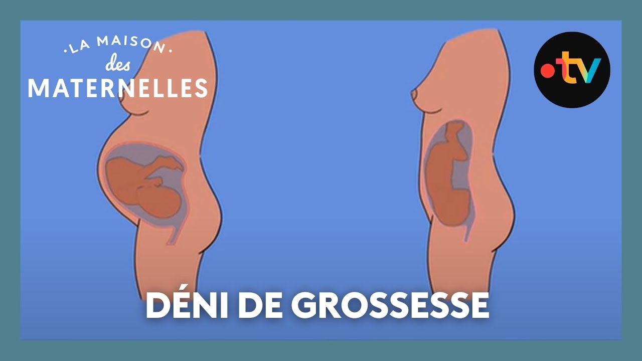 J'ai fait un déni total de grossesse - La Maison des maternelles #LMDM