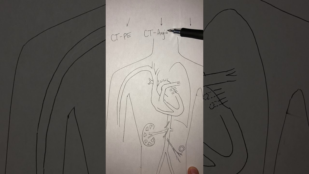 Different contrast-enhanced CT protocols