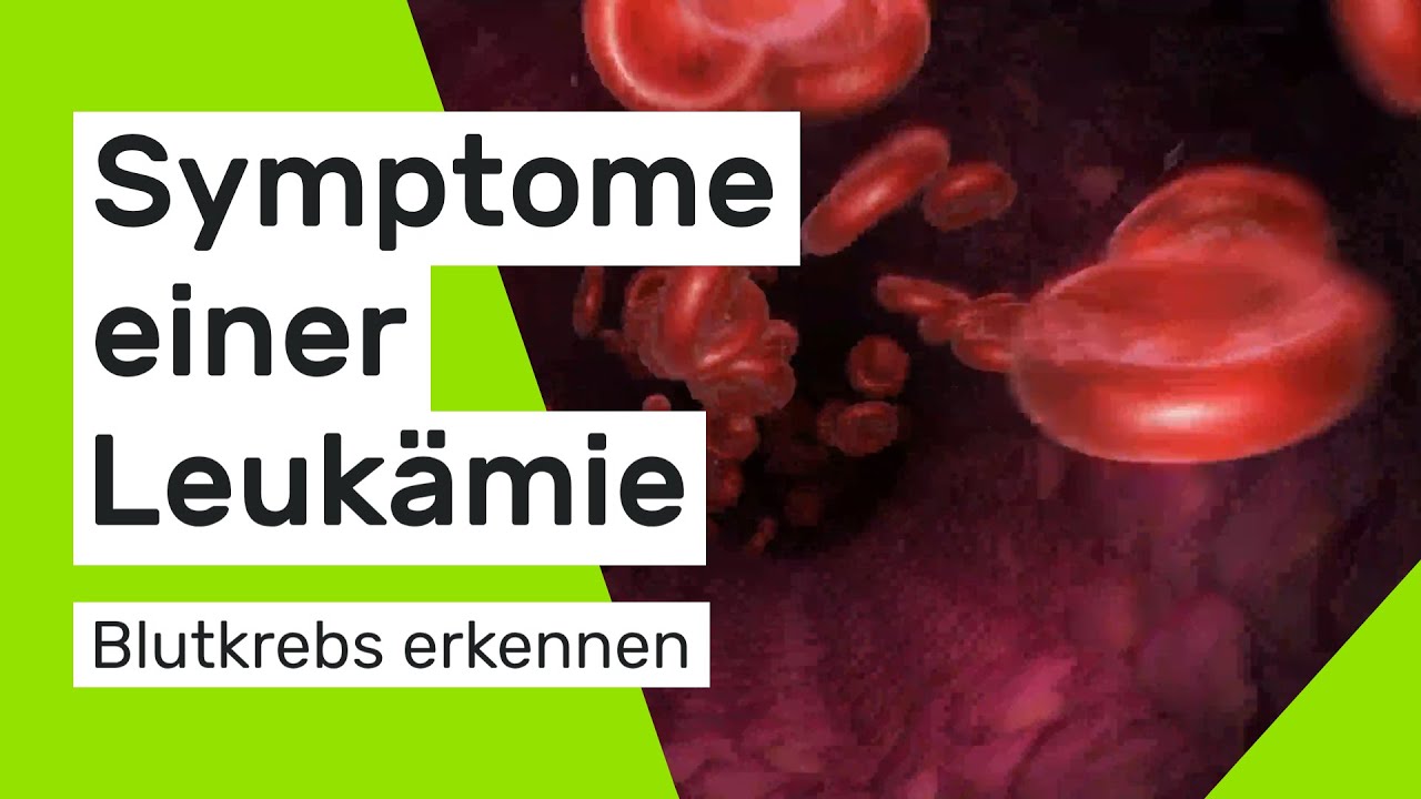 Symptome einer Leuk&auml;mie: So erkennen Sie Blutkrebs