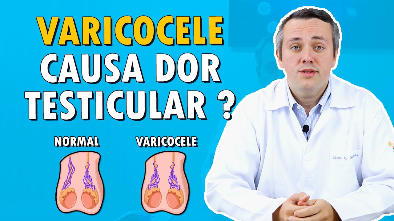 Varicocele Causa Dor No Testículo? | Dr. Claudio Guimarães