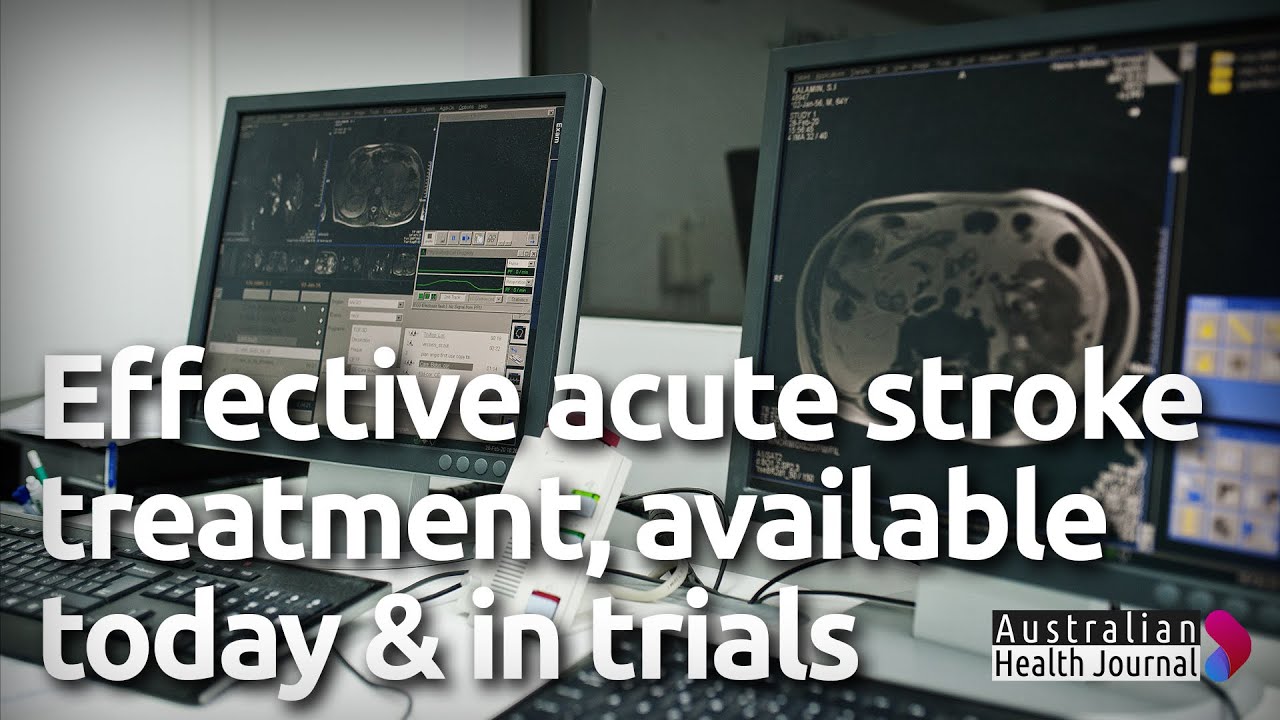 Building the case for faster and more effective acute stroke treatment